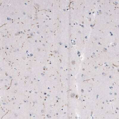 Immunohistochemistry-Paraffin: Tryptophan hydroxylase 2 Antibody (CL2990) [NBP2-46646]