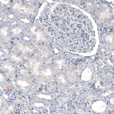 Immunohistochemistry-Paraffin: Tryptophan hydroxylase 2 Antibody (CL2990) [NBP2-46646]