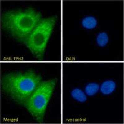 Immunocytochemistry/ Immunofluorescence: Tryptophan hydroxylase 2 Antibody [NB100-2447]