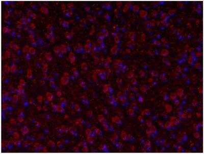 Immunocytochemistry/ Immunofluorescence: Tryptophan hydroxylase 2 Antibody - BSA Free [NB100-74555]