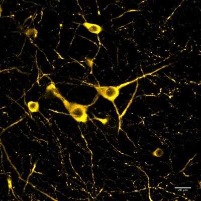 Immunohistochemistry Free-Floating: Tryptophan hydroxylase 2 Antibody - BSA Free [NB100-74555]