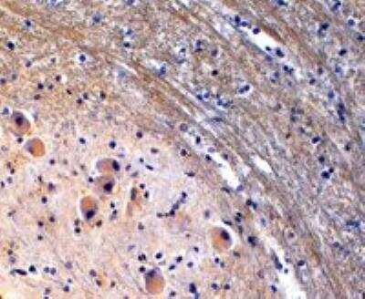 Immunohistochemistry-Paraffin: Tryptophan hydroxylase 2 Antibody [NB100-2447]