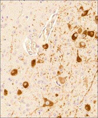 Immunohistochemistry-Paraffin: Tryptophan hydroxylase 2 Antibody - BSA Free [NB100-74555]