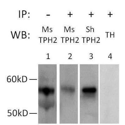 Immunoprecipitation: Tryptophan hydroxylase 2 Antibody - BSA Free [NB100-74555]