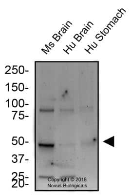 Western Blot: Tryptophan hydroxylase 2 AntibodyBSA Free [NB100-74555]