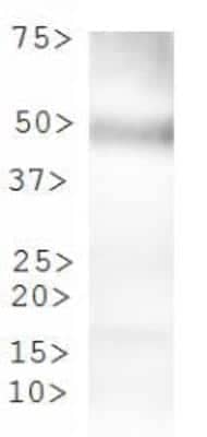 Western Blot: Tryptophan hydroxylase 2 AntibodyBSA Free [NBP1-77559]