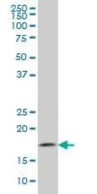 Western Blot: Tryptophan rich protein Antibody (2A3) [H00007485-M04]