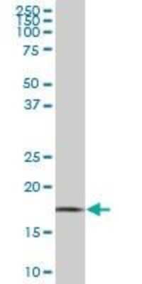 Western Blot: Tryptophan rich protein Antibody (4D6) [H00007485-M05]