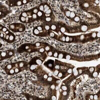 Immunohistochemistry-Paraffin: Tryptophan rich protein Antibody [NBP1-84492]