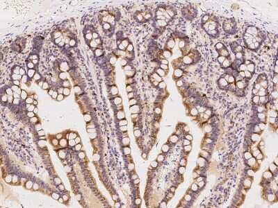 Immunohistochemistry-Paraffin: Tryptophan rich protein Antibody [NBP2-97813]