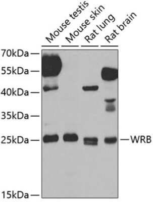 Western Blot: Tryptophan rich protein AntibodyBSA Free [NBP2-94520]