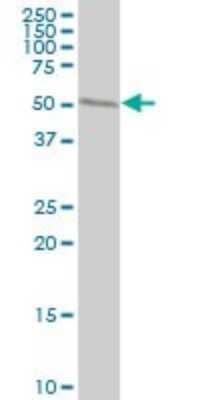 Western Blot: Tryptophanyl tRNA synthetase Antibody (3A12) [H00007453-M02]