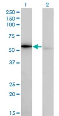 Western Blot: Tryptophanyl tRNA synthetase Antibody (3A12) [H00007453-M02]