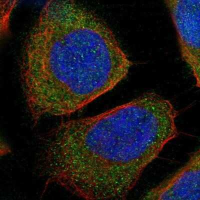 Immunocytochemistry/ Immunofluorescence: Tryptophanyl tRNA synthetase Antibody [NBP2-55377]