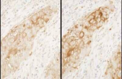 Immunohistochemistry: Tryptophanyl tRNA synthetase Antibody [NBP2-32185]