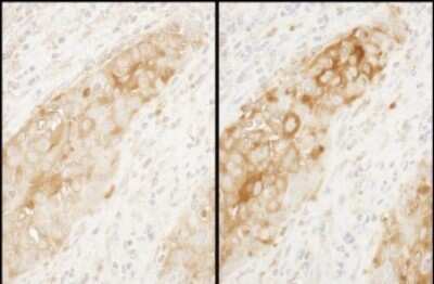 Immunohistochemistry-Paraffin: Tryptophanyl tRNA synthetase Antibody [NBP2-32186]