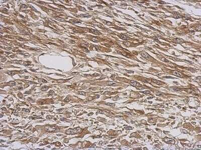 Immunohistochemistry-Paraffin: Tryptophanyl tRNA synthetase Antibody [NBP2-20743]