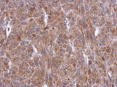 Immunohistochemistry-Paraffin: Tryptophanyl tRNA synthetase Antibody [NBP2-20743]