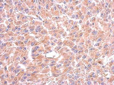 Immunohistochemistry-Paraffin: Tryptophanyl tRNA synthetase Antibody [NBP2-20744]