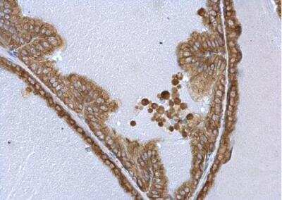 Immunohistochemistry-Paraffin: Tryptophanyl tRNA synthetase Antibody [NBP2-20744]