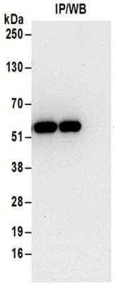 Immunoprecipitation: Tryptophanyl tRNA synthetase Antibody [NBP2-32185]