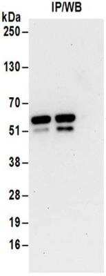 Immunoprecipitation: Tryptophanyl tRNA synthetase Antibody [NBP2-32186]