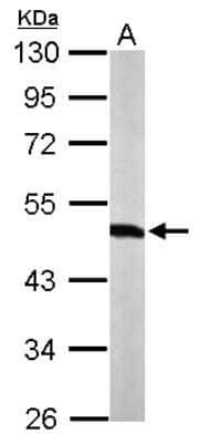 Western Blot: Tryptophanyl tRNA synthetase Antibody [NBP2-20744]