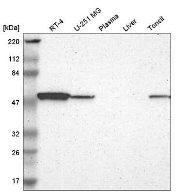 Western Blot: Tryptophanyl tRNA synthetase Antibody [NBP2-55159]