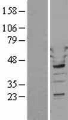 Western Blot: Tryptophanyl tRNA synthetase Overexpression Lysate [NBL1-17772]