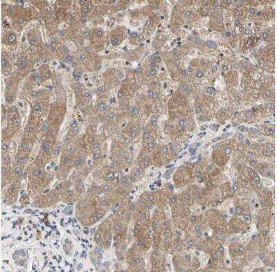 Immunohistochemistry-Paraffin: Tsukushi/TSK Antibody [NBP1-87959]