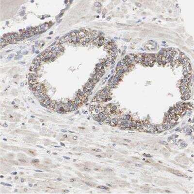 Immunohistochemistry-Paraffin: Tsukushi/TSK Antibody [NBP1-87959]