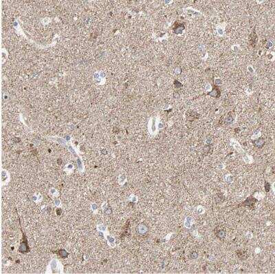 Immunohistochemistry-Paraffin: Tsukushi/TSK Antibody [NBP1-87959]