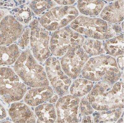 Immunohistochemistry-Paraffin: Tsukushi/TSK Antibody [NBP1-87959]