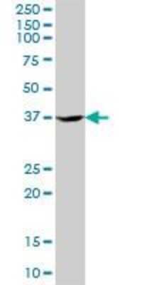 Western Blot: Tsukushi/TSK Antibody [H00025987-B01P]