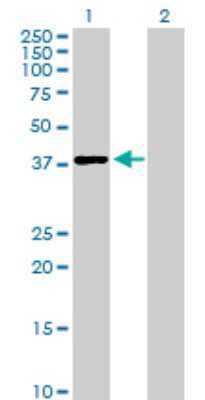 Western Blot: Tsukushi/TSK Antibody [H00025987-B01P]