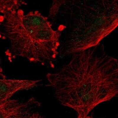 Immunocytochemistry/ Immunofluorescence: Tubby Antibody [NBP1-87824]