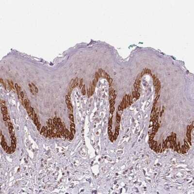 Immunohistochemistry: Tubby Antibody [NBP2-48924]