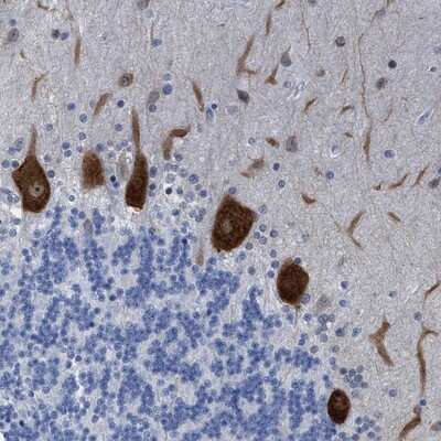 Immunohistochemistry-Paraffin: Tubby Antibody [NBP1-87824]