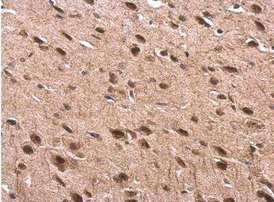 Immunohistochemistry-Paraffin: Tubby Antibody [NBP2-20758]