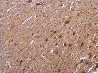 Immunohistochemistry-Paraffin: Tubby Antibody [NBP2-20758]