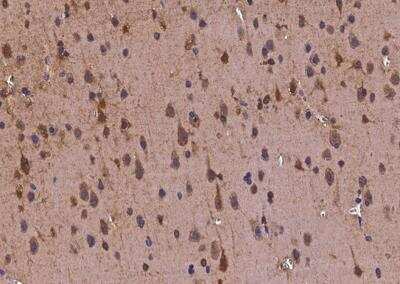 Immunohistochemistry-Paraffin: Tubby Antibody [NBP2-97149]