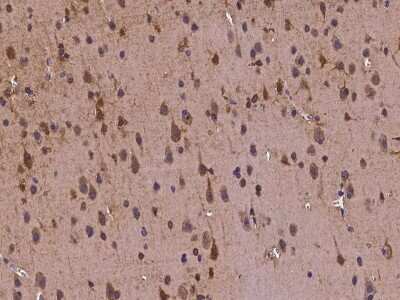 Immunohistochemistry-Paraffin: Tubby Antibody [NBP2-97149]