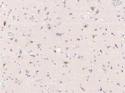 Immunohistochemistry-Paraffin: Tubby Antibody [NBP2-99110]