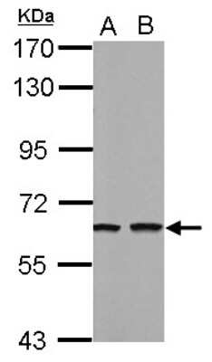 Western Blot: Tubby Antibody [NBP2-20758]