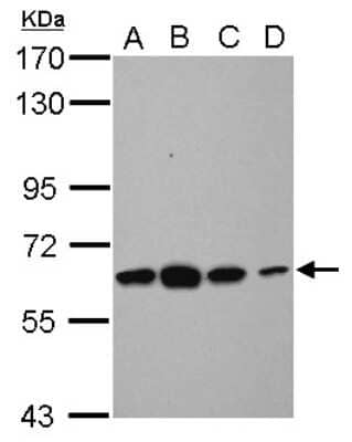 Western Blot: Tubby Antibody [NBP2-20758]