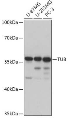 Western Blot: Tubby AntibodyAzide and BSA Free [NBP2-93966]