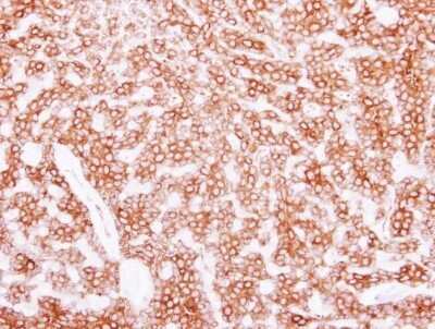 Immunohistochemistry-Paraffin: Tubulin Beta 2C Antibody [NBP2-14886]