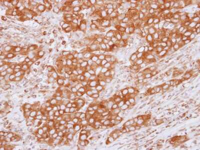 Immunohistochemistry-Paraffin: Tubulin Beta 2C Antibody [NBP2-14887]