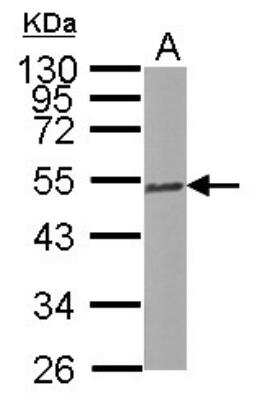 Western Blot: Tubulin Beta 2C Antibody [NBP2-14887]