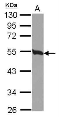 Western Blot: Tubulin Beta 2C Antibody [NBP2-14887]